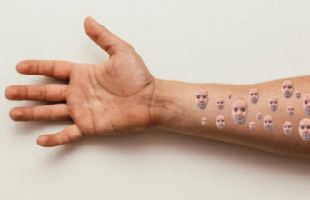 Malta confirms first case of Geraldpox
